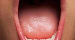 تعبیر خواب دهان امام صادق و ابن سیرین و بیرون کشیدن چیزی از دهان باز و کثیف