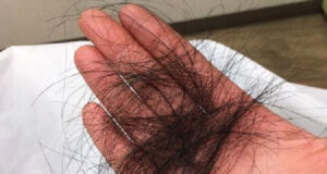 تعبیر خواب کنده شدن موی سر دختر مجرد + زن متاهل از ساقه و ریشه با دست