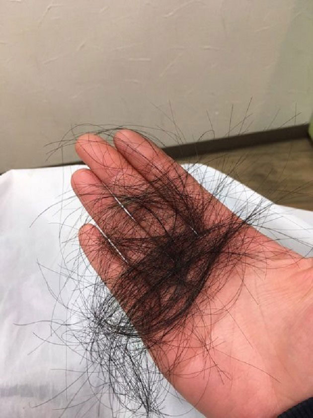 تعبیر خواب کنده شدن موی سر دختر مجرد + زن متاهل از ساقه و ریشه با دست