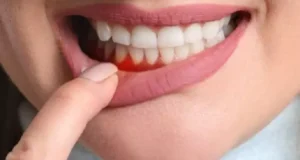 تعبیر خواب لق شدن دندان امام صادق و حضرت یوسف + کندن با دست بدون خونریزی