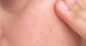 تعبیر خواب موی زائد بدن و صورت + زیر بغل و عورت برای زنان و دختران مجرد