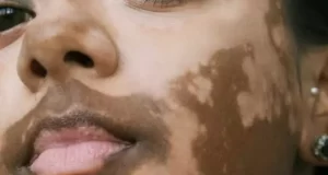 تعبیر خواب سیاه شدن صورت مرد و زن و دیگران + آیا نشانه غم و اندوه می باشد؟