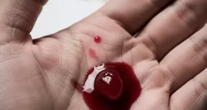 تعبیر خواب لخته خون از دهان و بینی و ادرار + از واژن زن متاهل و دختر مجرد